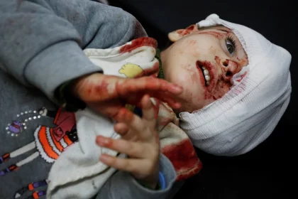 Gazze Yaralı Çocuk